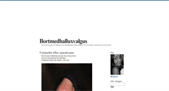 Desktop Screenshot of bortmedhalluxvalgus.blogg.se