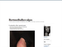 Tablet Screenshot of bortmedhalluxvalgus.blogg.se